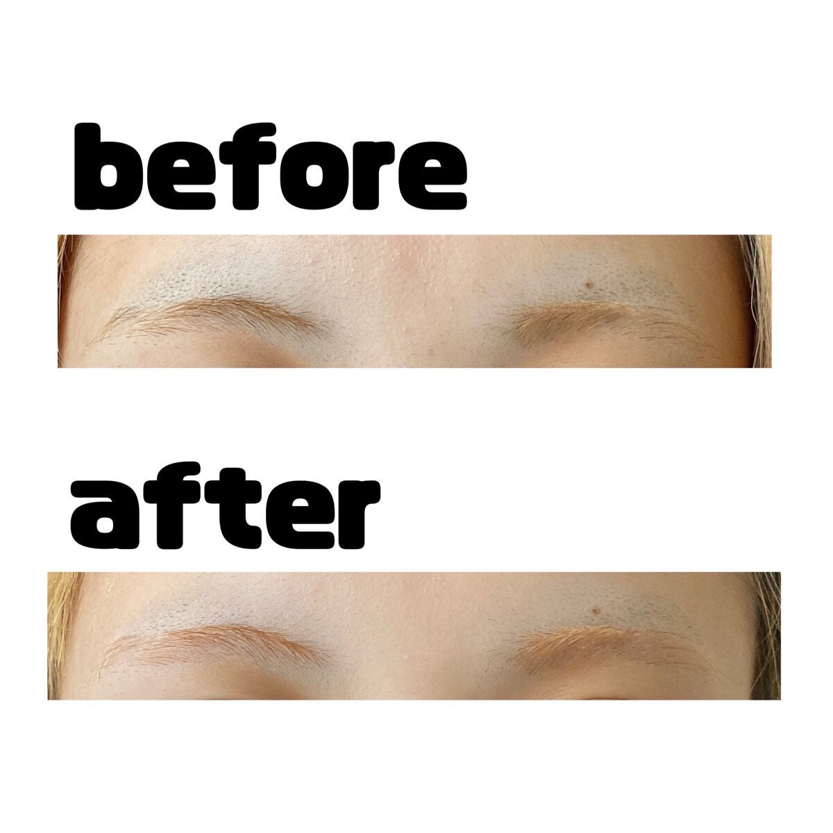 脱色クリーム スピーディー/エピラット/ムダ毛ケアを使ったクチコミ(3枚目)