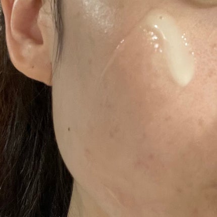 ユース ラディアンス ビタチノール セラム/primera/美容液を使ったクチコミ(3枚目)