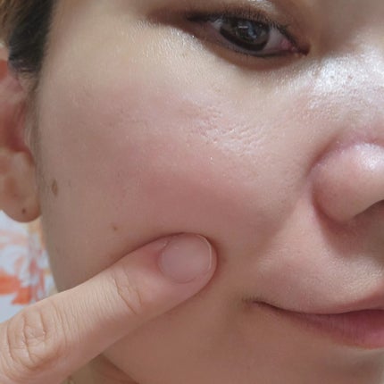 たまご化粧水/ココエッグ/化粧水を使ったクチコミ(3枚目)