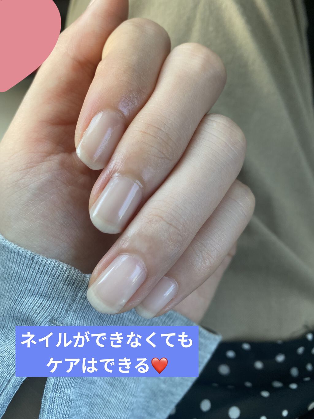 ネイルケアプロテクター/オルビス/ネイルオイル・トリートメントを使ったクチコミ（2枚目）