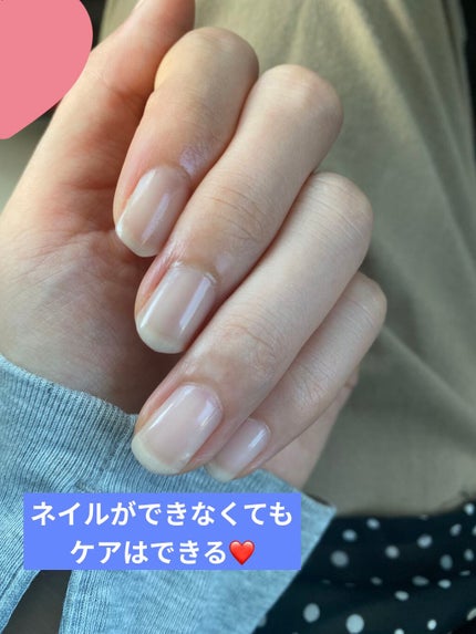 ネイルケアプロテクター/オルビス/ネイルオイル・トリートメントを使ったクチコミ(2枚目)