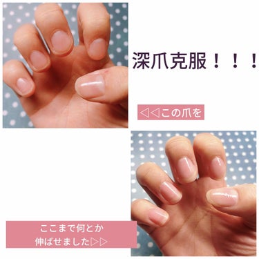 ネイルホリック Top coat/ネイルホリック/ネイルトップコート・ベースコートを使ったクチコミ（1枚目）