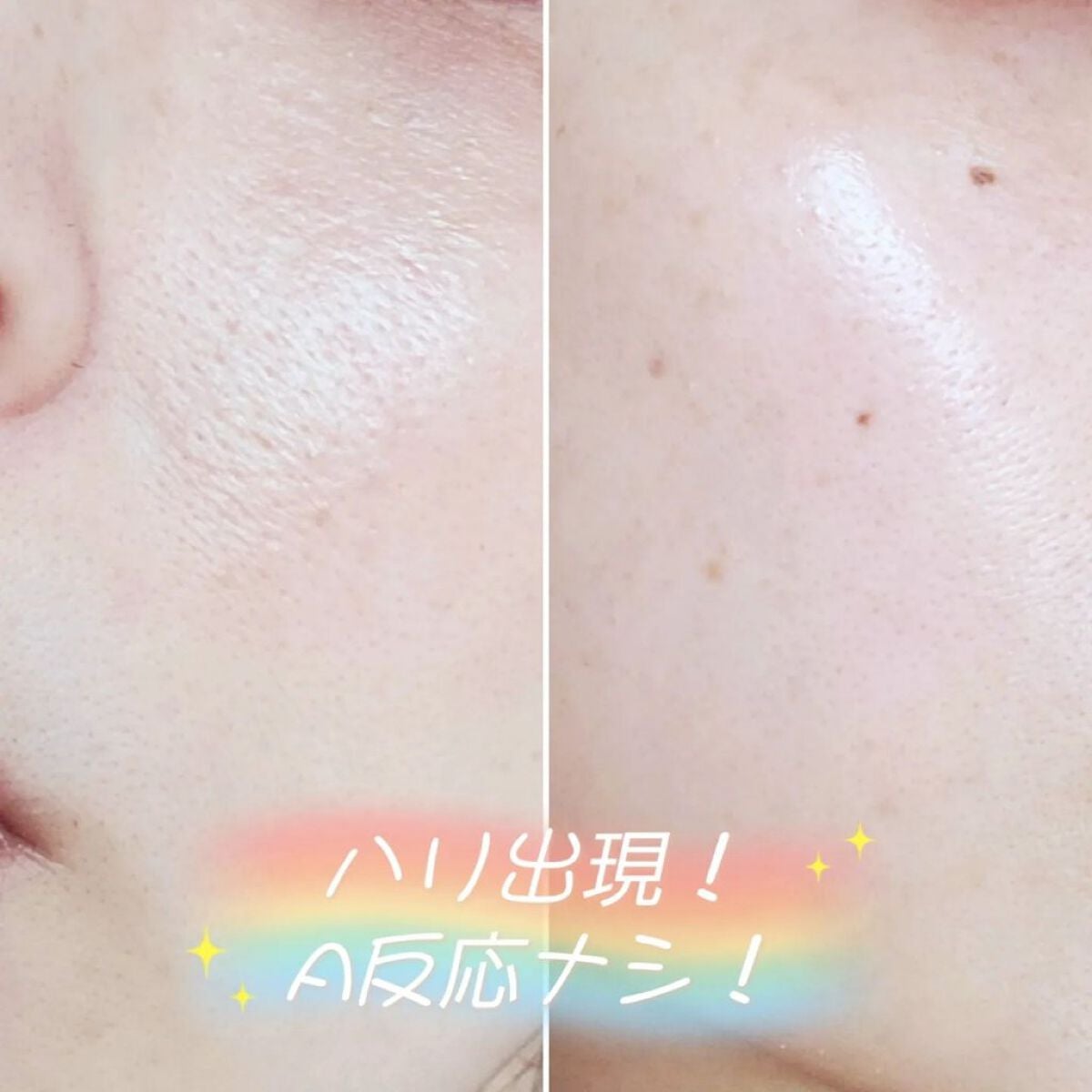 レチノールインテンシブ アドバンスドトリプルアクションアイクリーム/SOME BY MI/アイケア・アイクリームを使ったクチコミ(5枚目)