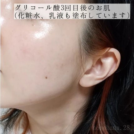 レチノールセラム/ADVANCED CLINICALS/美容液を使ったクチコミ(5枚目)