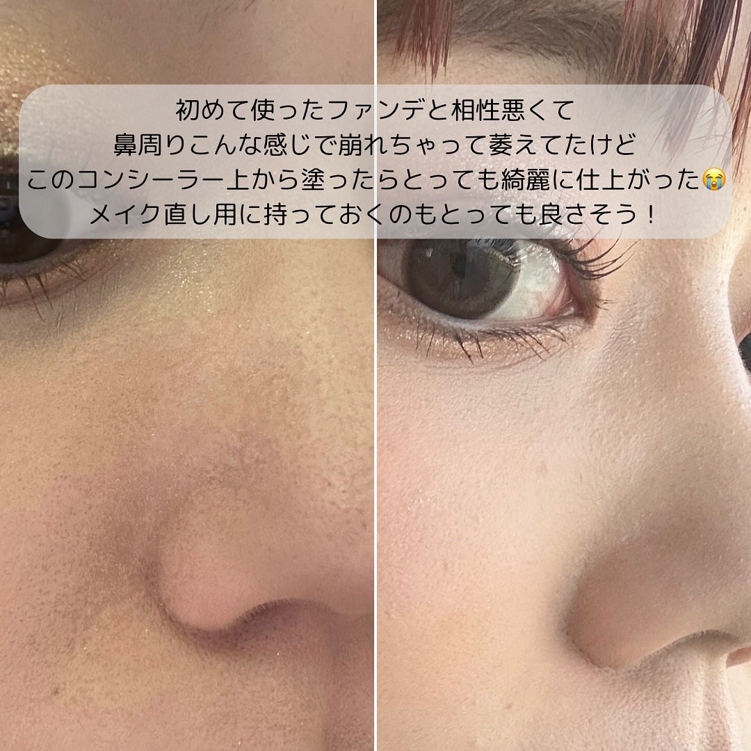ダーマシンコンシーラー/23years old/リキッドコンシーラーを使ったクチコミ(4枚目)