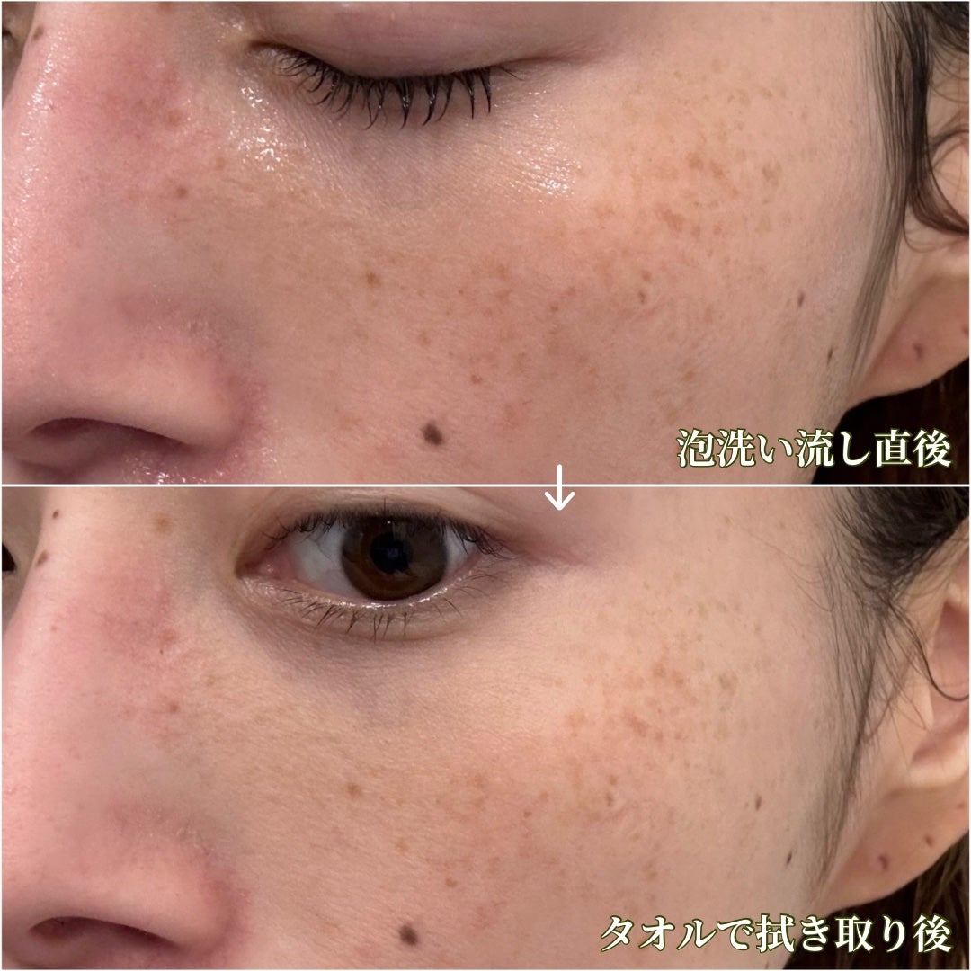 マイルドスキンバランシングヴィーガンクレンザー/ダルバ/洗顔フォームを使ったクチコミ(7枚目)