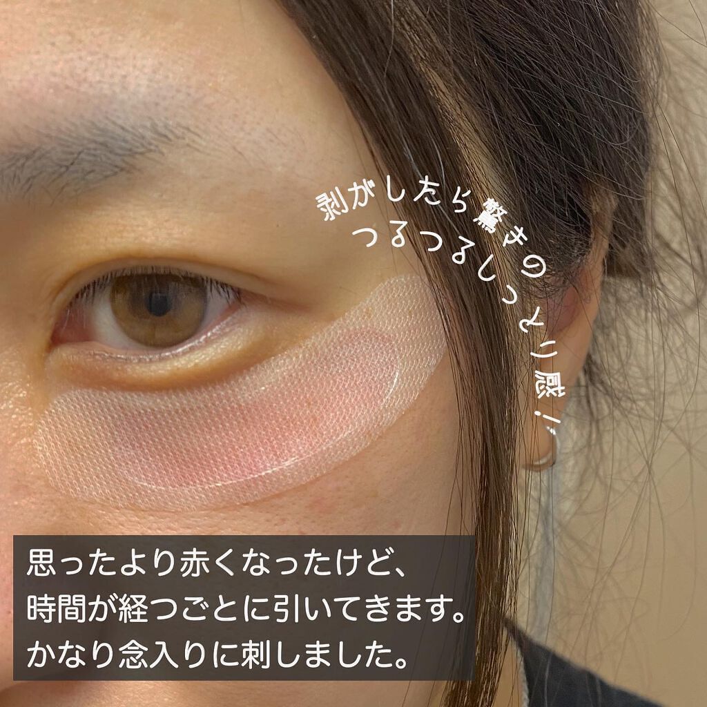 リクエス コンセントレート チャージ パッチ/クラブ/シートマスク・パックを使ったクチコミ(4枚目)