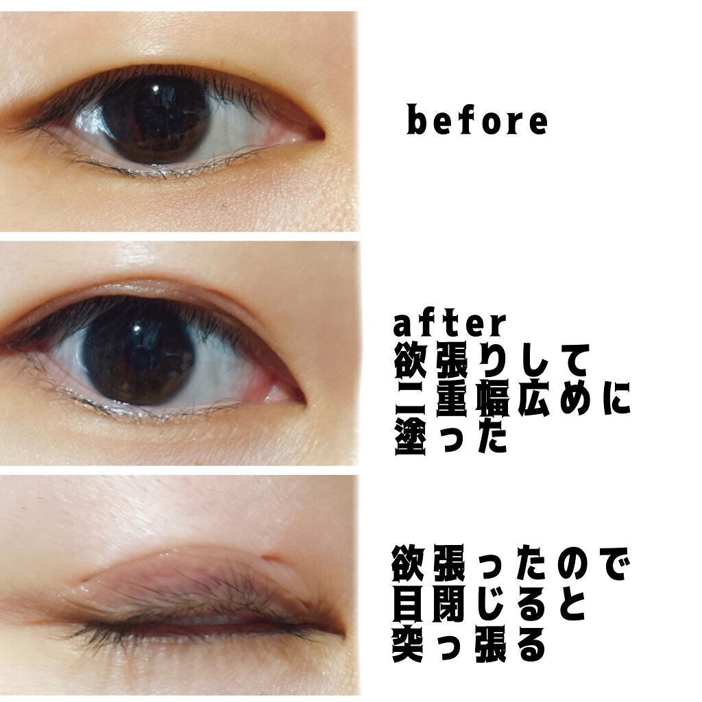 アイトーク 大人のまぶたコントロール/アイトーク/二重まぶた用アイテムを使ったクチコミ(2枚目)