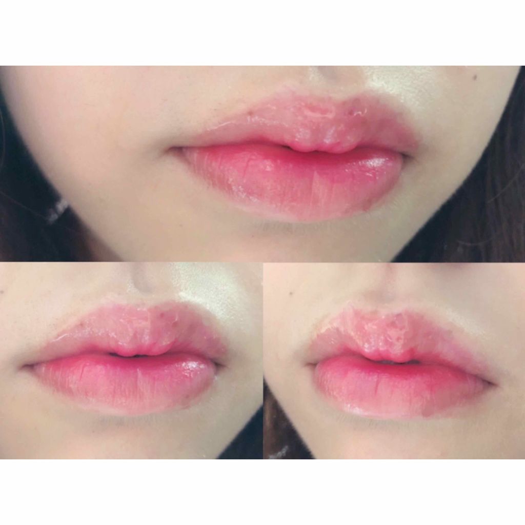 ディアダーリン ウォータージェルティント （アイスティント）/ETUDE/口紅を使ったクチコミ（2枚目）