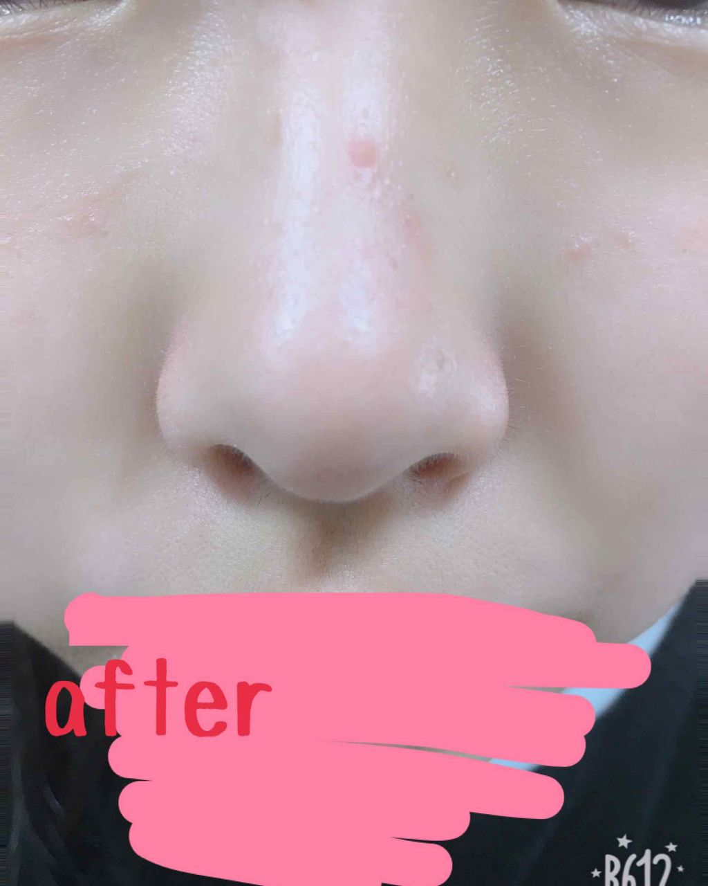 フェイスピーリングジェル ピーチの香り/DAISO/ピーリングを使ったクチコミ(4枚目)