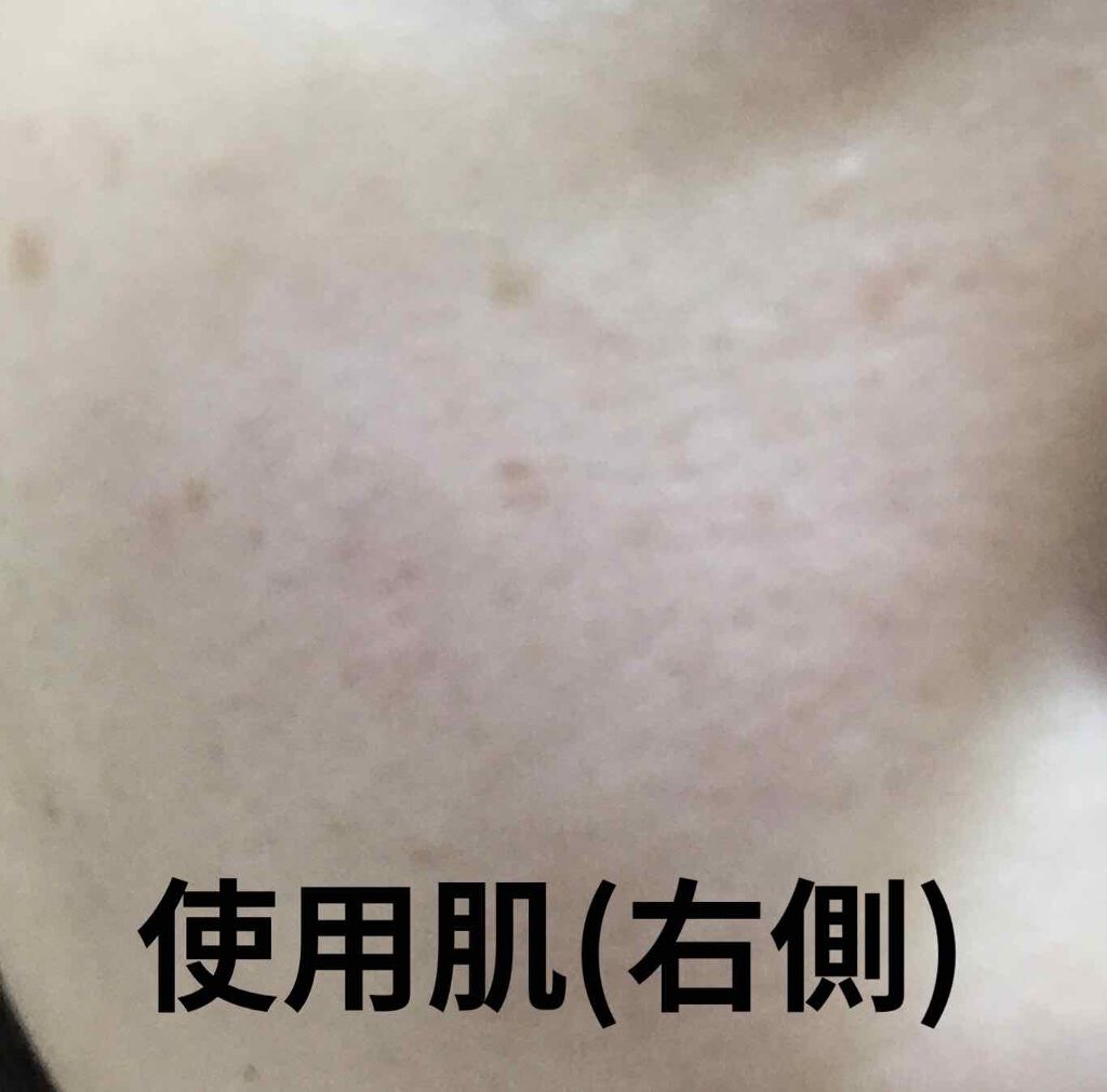 試してみた】パーフェクトアクアリーボーテ2 Beauteのリアルな 試してみた】パーフェクトアクアリーボーテ2 Beauteのリアルな