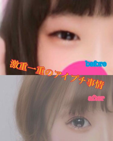 まろろん🦄🌙💜 on LIPS 「激重一重の私が皮膜式アイプチで目がぱちくりになった方法！！まず..」（1枚目）