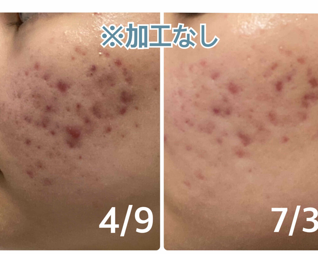 Cサスペンション23+HAスフィア2フェイスクリーム/The Ordinary/美容液を使ったクチコミ（1枚目）