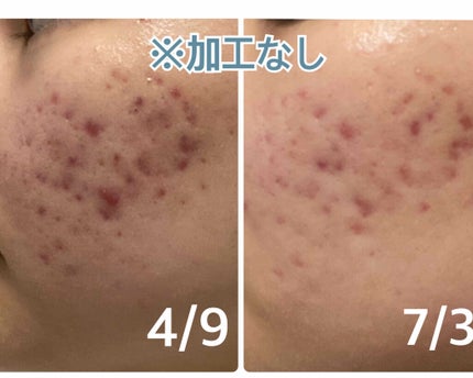 Cサスペンション23+HAスフィア2フェイスクリーム/The Ordinary/美容液を使ったクチコミ(1枚目)