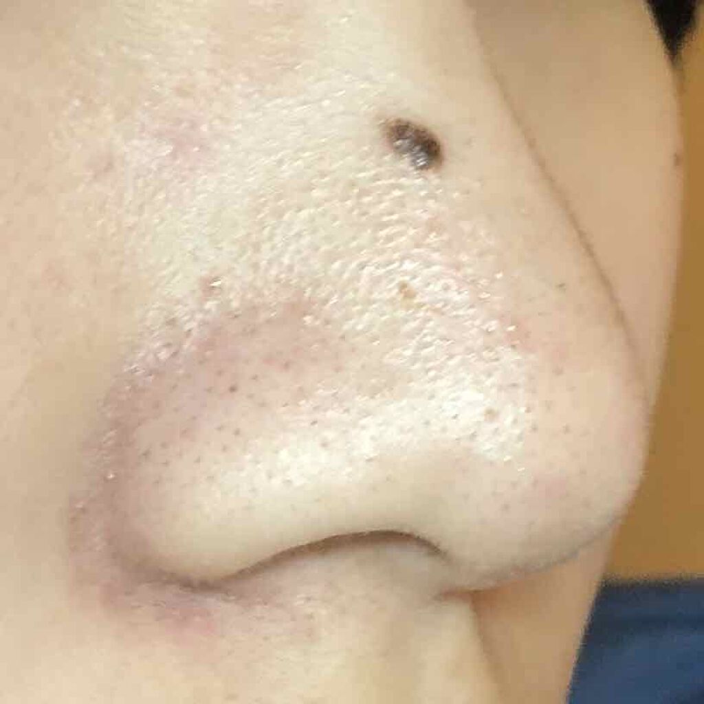 ハトムギ化粧水(ナチュリエ スキンコンディショナー R )/ナチュリエ/化粧水を使ったクチコミ（3枚目）