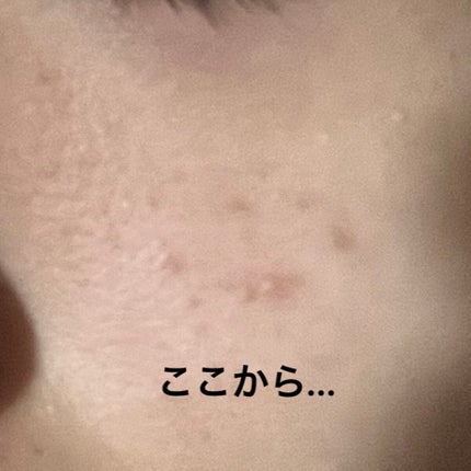 桃70%ナイアシンセラム/Anua/美容液を使ったクチコミ(3枚目)