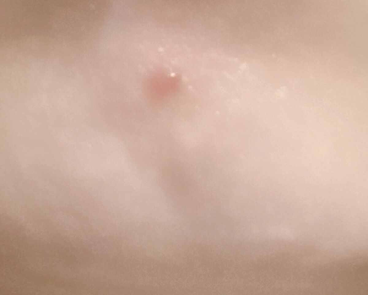 ハトムギ化粧水(ナチュリエ スキンコンディショナー R )/ナチュリエ/化粧水を使ったクチコミ（3枚目）