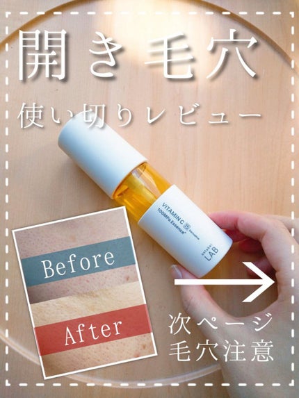 V エッセンス/unlabel/美容液を使ったクチコミ(1枚目)