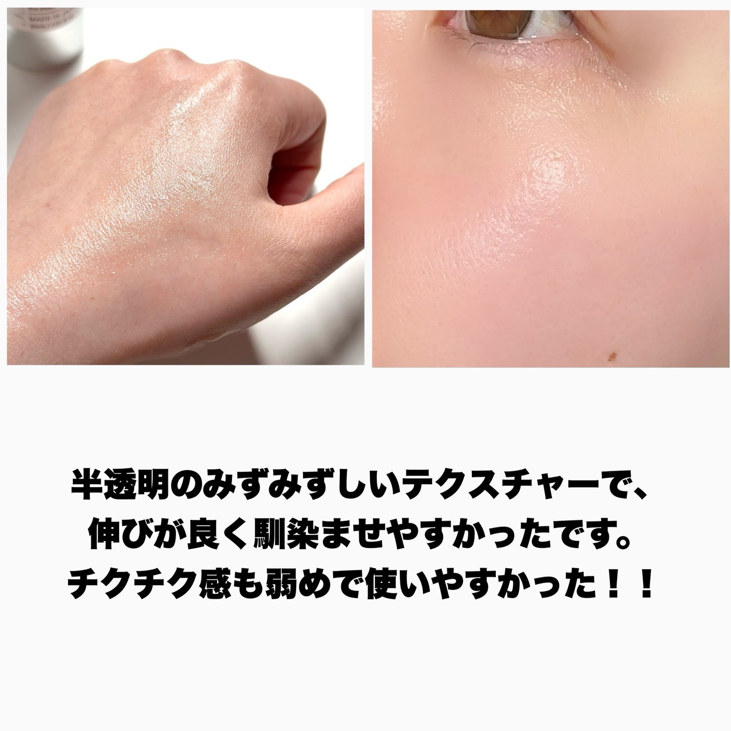 fractionalCC ニードルセラムC/fractionalCC/美容液を使ったクチコミ(4枚目)