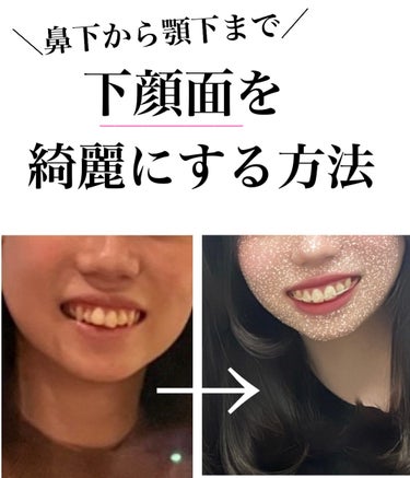 今回は下顔面を綺麗にする方法を紹介していきます！！

＼そもそも下顔面とは？／　

鼻下から顎先までのこと！
ちなみにおでこの生え際から眉までを上顔面、眉から鼻下までを中顔面と呼ぶよ！！

この上顔面、