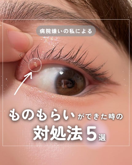 ロート抗菌目薬EX(医薬品)/ロート製薬/その他を使ったクチコミ(1枚目)