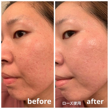 UVã€ã㢠XL ãããã¯ã·ã§ã³ããŒã³ã¢ãã ããŒãº/ã© ããã·ã¥ ããŒ/æ¥çŒãæ¢ãã¯ãªãŒã ã䜿ã£ãã¯ãã³ãïŒ7æç®ïŒ