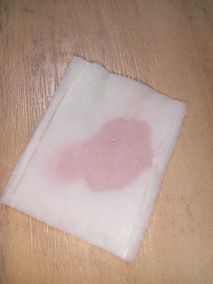 オイデルミン(N)/SHISEIDO/化粧水を使ったクチコミ(2枚目)