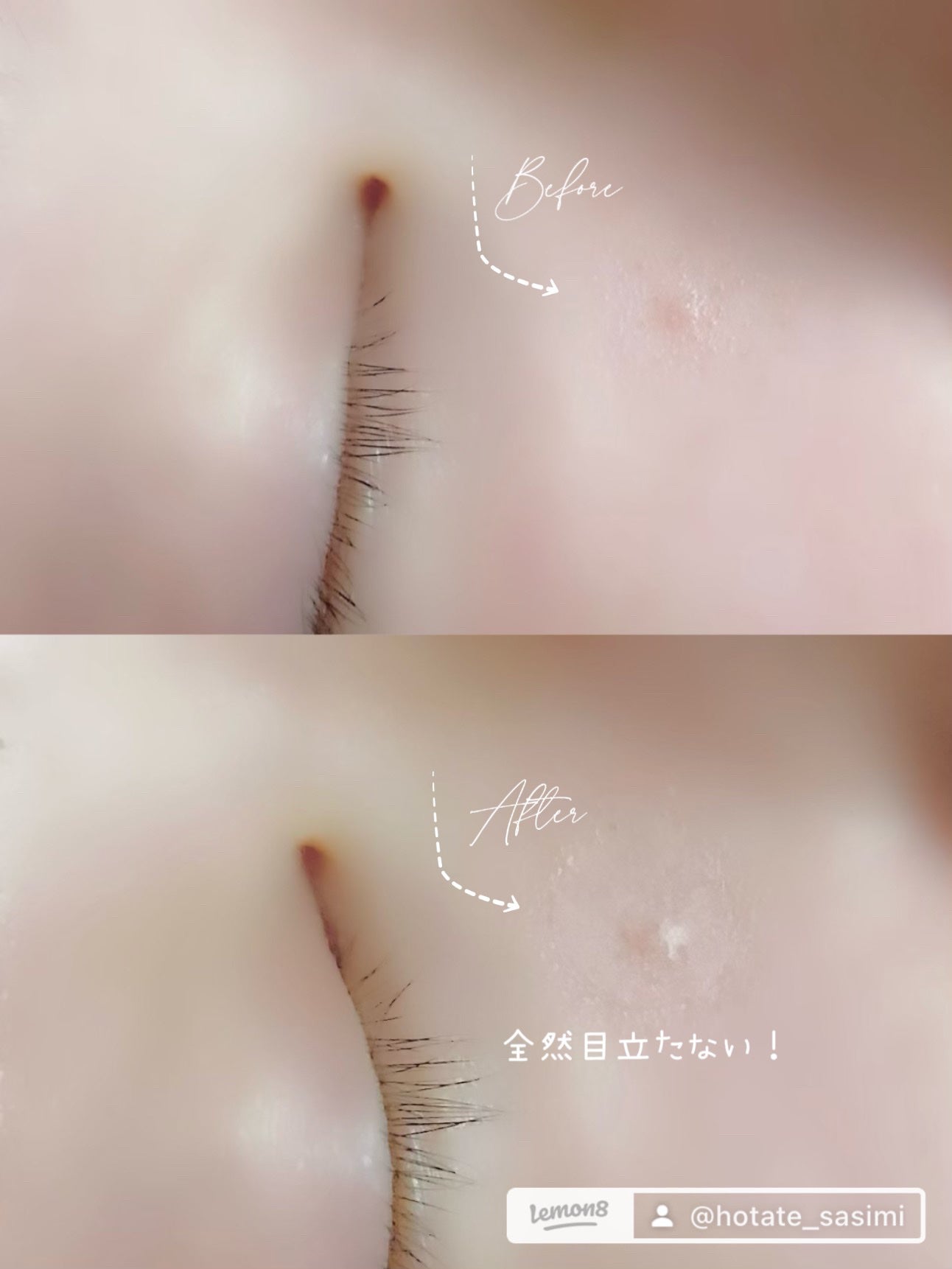 ごめんね素肌 キニナルマスク/クリアターン/シートマスク・パックを使ったクチコミ(8枚目)