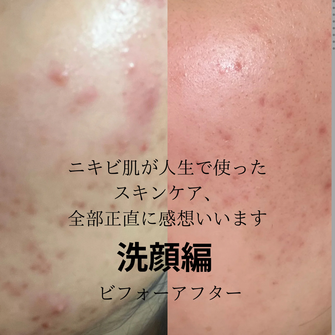 スキンケア洗顔料 スクラブin/ビオレ/洗顔フォームを使ったクチコミ（1枚目）