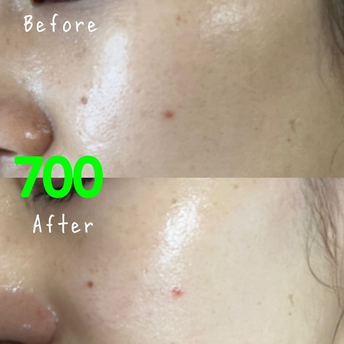 リードルショット100/VT/美容液を使ったクチコミ(7枚目)