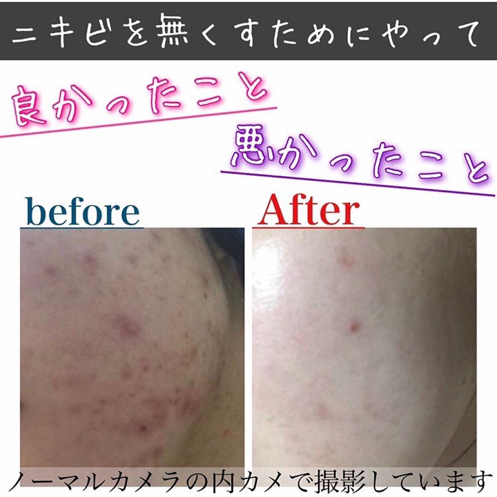 を使ったクチコミ（1枚目）