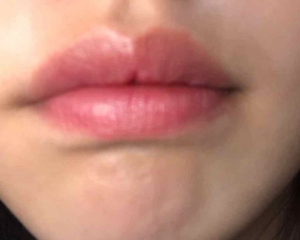 モイスチャーティント/ヴァセリン/リップティントを使ったクチコミ(2枚目)