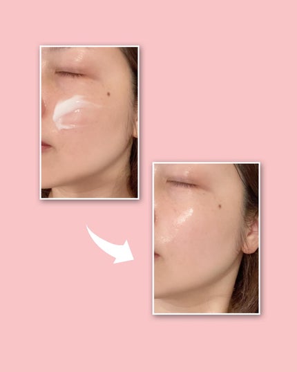 レッドブレミッシュ クリアスージングクリーム/Dr.G/フェイスクリームを使ったクチコミ(4枚目)