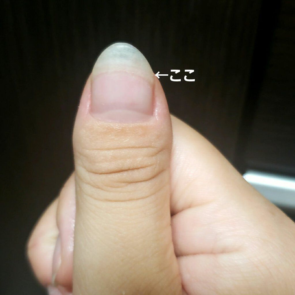 ジェルネイル（ライト対応）/セリア/ジェルネイルを使ったクチコミ（2枚目）