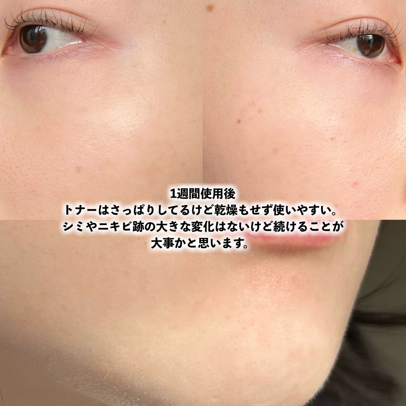 シカレチA エッセンス0.1/VT/美容液を使ったクチコミ(8枚目)