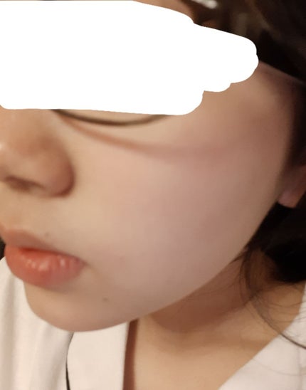 ロゼット洗顔パスタ アクネクリア/ロゼット/洗顔フォームを使ったクチコミ(4枚目)