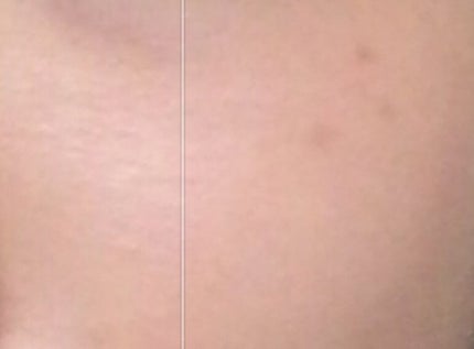 お米のパック/毛穴撫子/洗い流すパック・マスクを使ったクチコミ(2枚目)