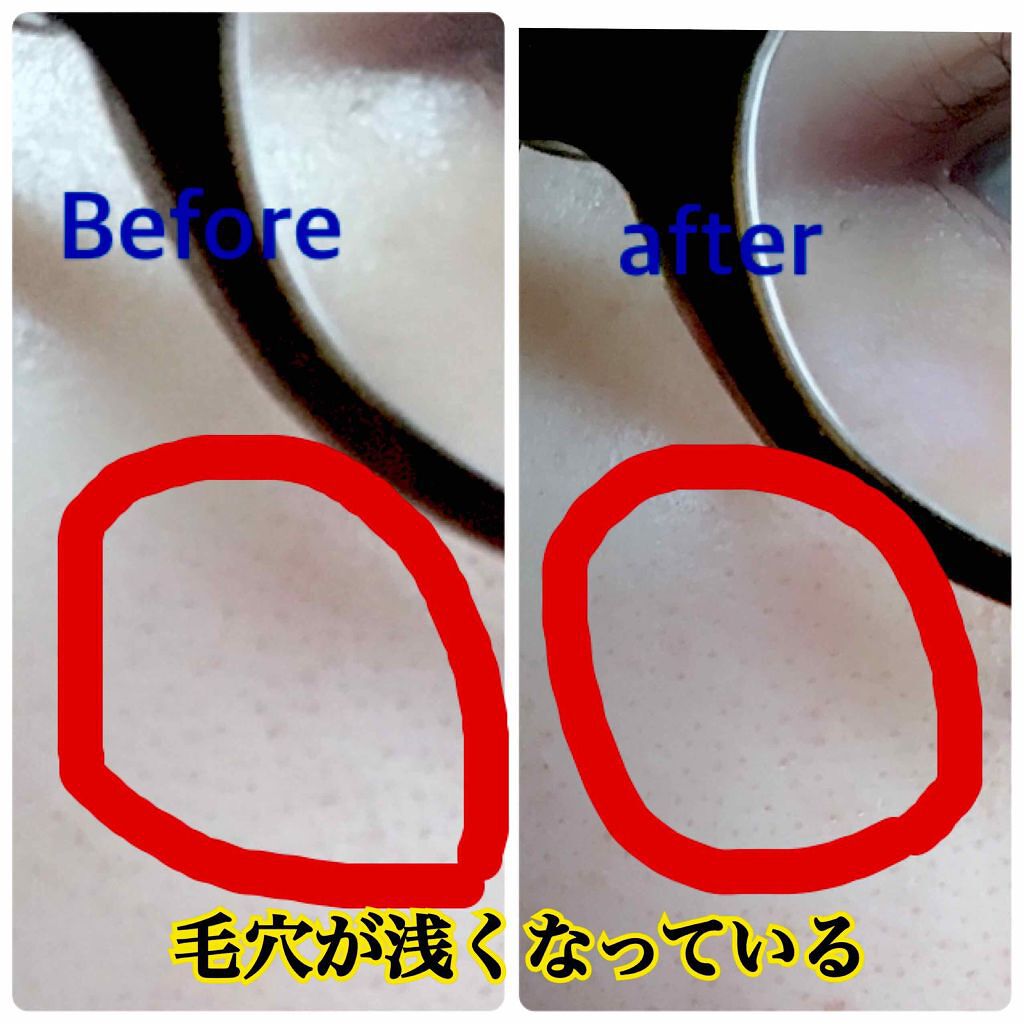 シーバムコントロールVCローション/プリモディーネ/化粧水を使ったクチコミ(2枚目)