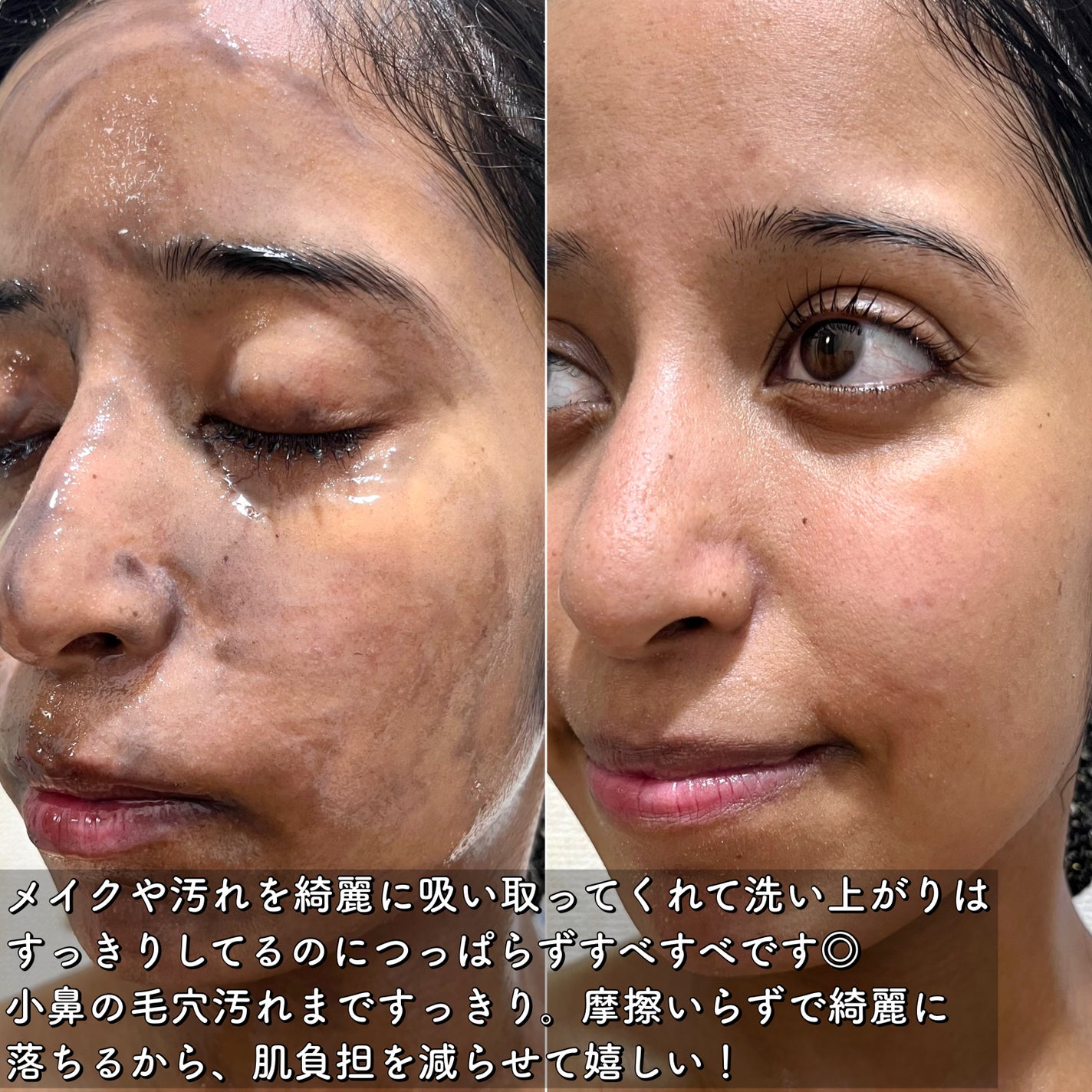 ブラックジェルクレンジング/.akaran/クレンジングジェルを使ったクチコミ(5枚目)