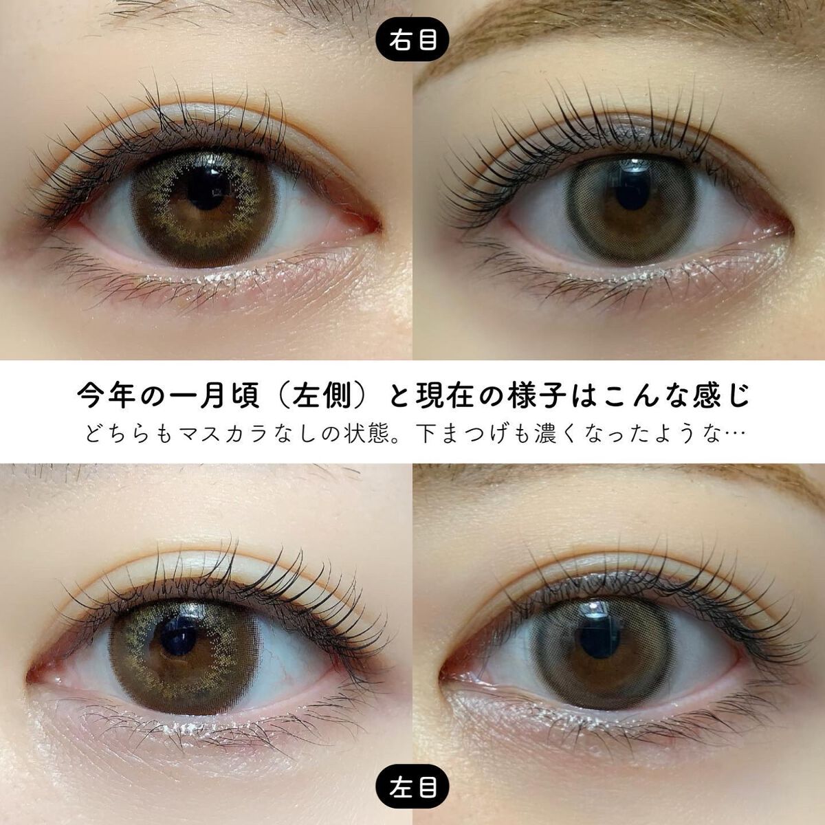 エグータム/アルマダスタイル/まつげ美容液を使ったクチコミ（3枚目）