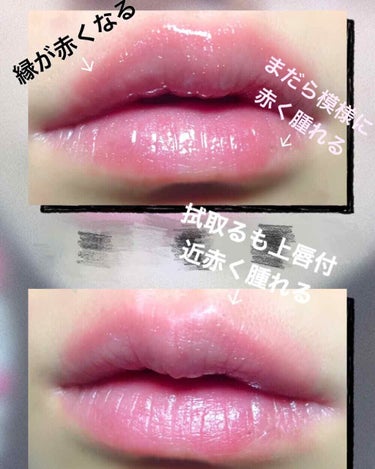 Plump Potion Needle-Free Plumping Cocktail/PHYSICIANS FORMULA/リップグロスを使ったクチコミ（3枚目）