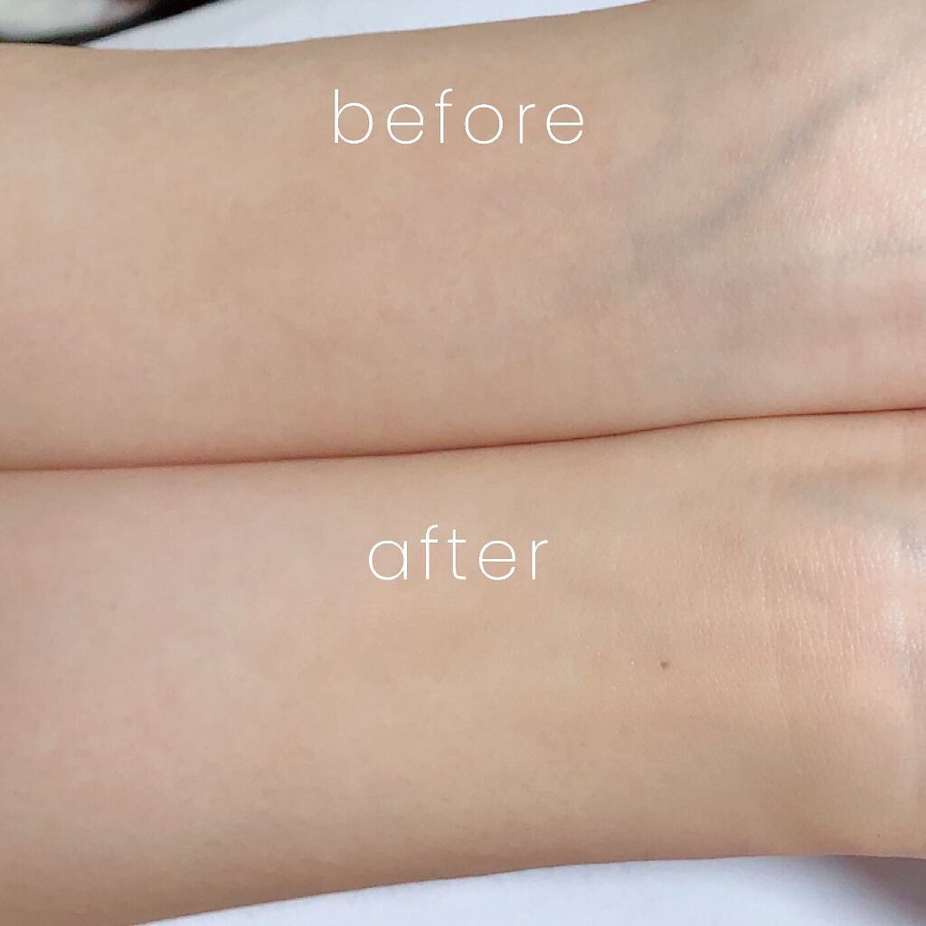 スキンカラーコントロール/ACSEINE/クリームコンシーラーを使ったクチコミ（2枚目）