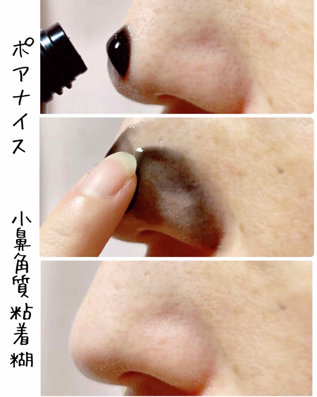 小鼻角質粘着糊/ポアナイス/シートマスク・パックを使ったクチコミ（3枚目）