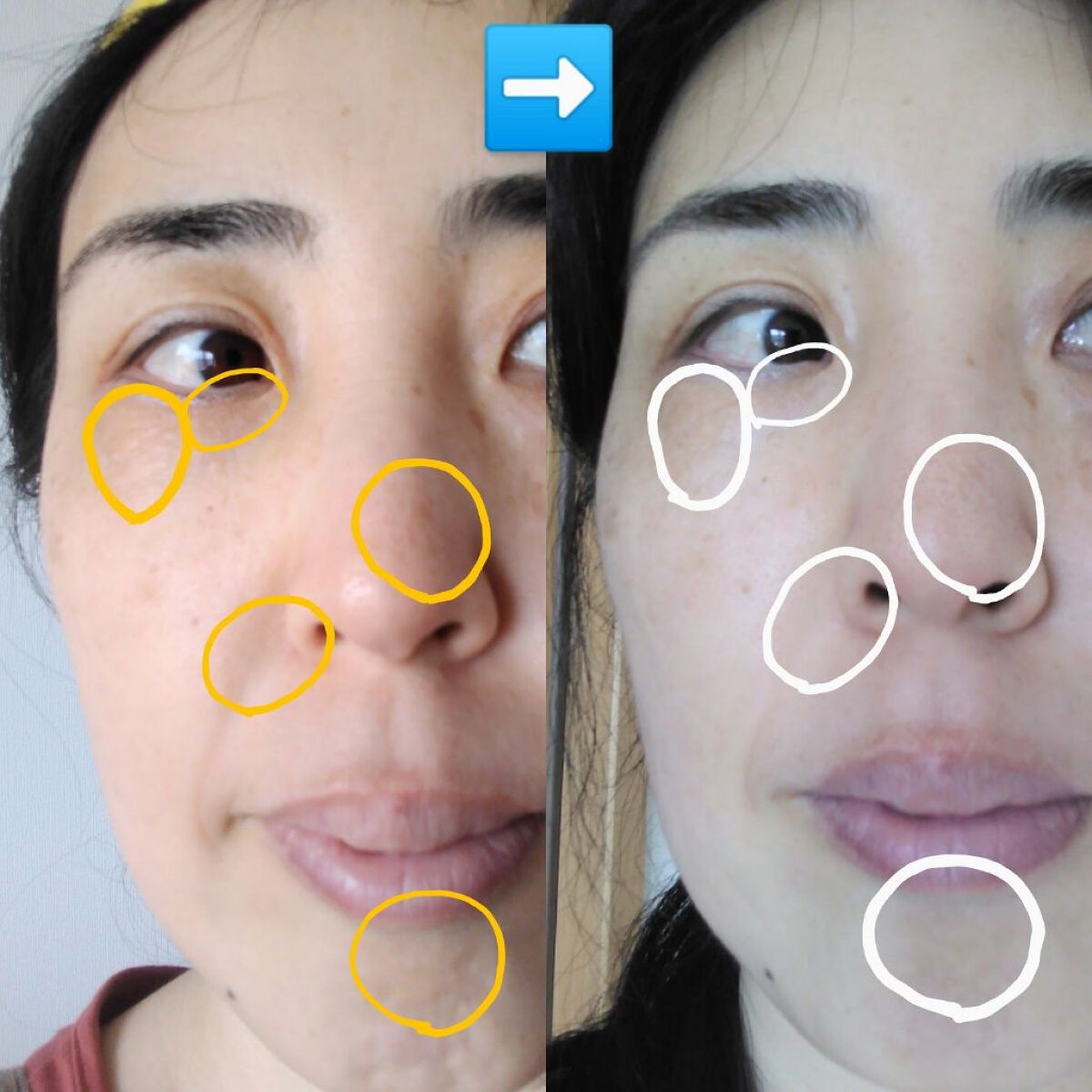 AC ピーリングソープ/NIKI PITA/洗顔石鹸を使ったクチコミ（2枚目）