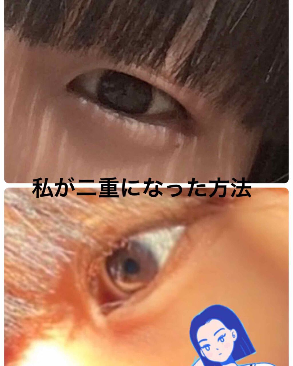 アイビューティー フィクサー WP/アストレア ヴィルゴ/二重まぶた用アイテムを使ったクチコミ（1枚目）