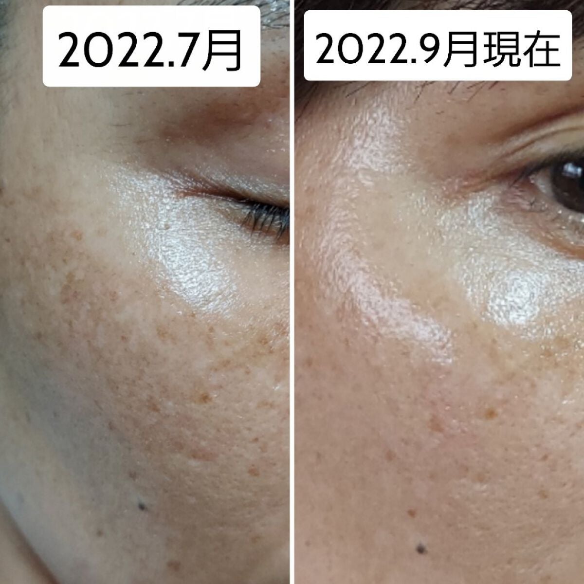 トーンショットクリーム/アバンタイム/フェイスクリームを使ったクチコミ(2枚目)