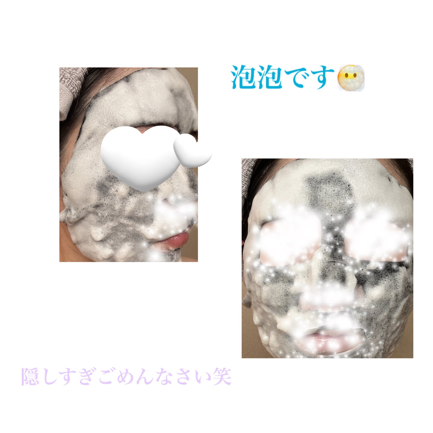 ブライトニング バブルトックス セラムマスク/MEDIHEAL/シートマスク・パックを使ったクチコミ(4枚目)