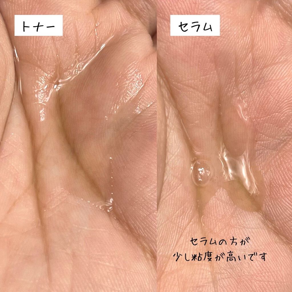 ガラクトミセスピュアビタミンCグロートナー/SOME BY MI/化粧水を使ったクチコミ（3枚目）