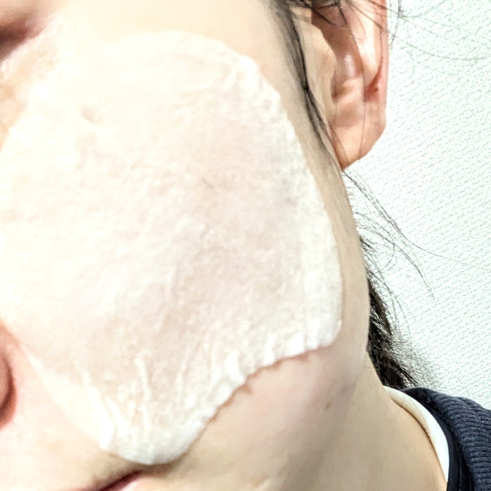 センテラ クイックカーミングパッド/SKIN1004/トナーパッドを使ったクチコミ（2枚目）