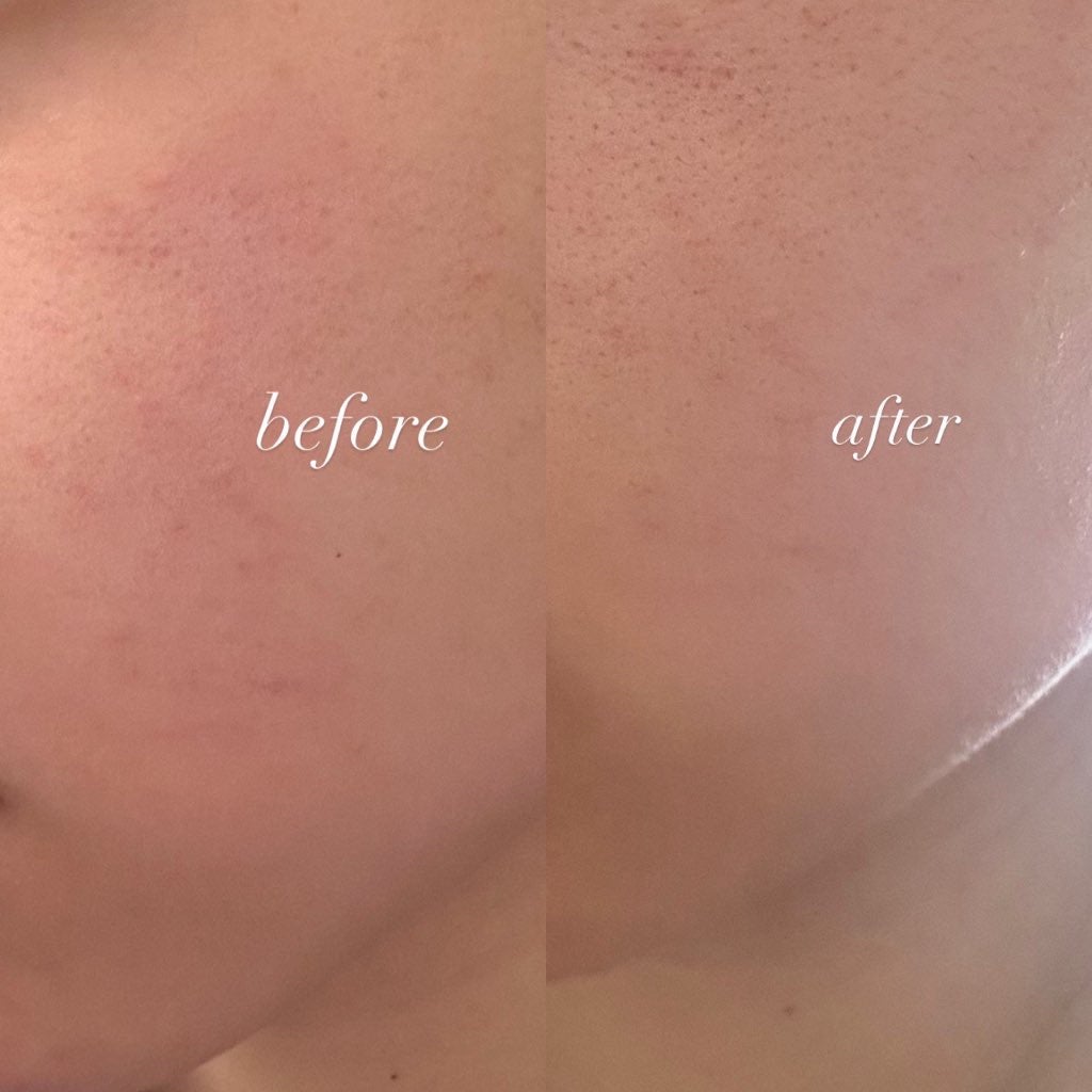 レッドブレミッシュ クリアスージングクリーム/Dr.G/フェイスクリームを使ったクチコミ(7枚目)